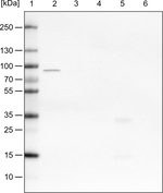 CARS Antibody in Western Blot (WB)