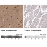CARS Monoclonal Antibody (CL2309)