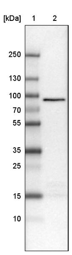 CARS Antibody in Western Blot (WB)