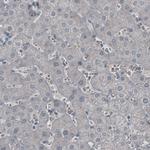 LY6K Antibody in Immunohistochemistry (Paraffin) (IHC (P))