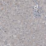 LY6K Antibody in Immunohistochemistry (Paraffin) (IHC (P))