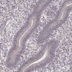 LY6K Antibody in Immunohistochemistry (Paraffin) (IHC (P))