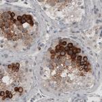 LY6K Antibody in Immunohistochemistry (Paraffin) (IHC (P))