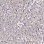 LY6K Antibody in Immunohistochemistry (Paraffin) (IHC (P))