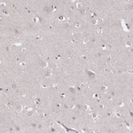 LY6K Antibody in Immunohistochemistry (Paraffin) (IHC (P))