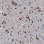 GRASP55 Antibody in Immunohistochemistry (Paraffin) (IHC (P))