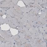 GRASP55 Antibody in Immunohistochemistry (Paraffin) (IHC (P))