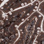 GRASP55 Monoclonal Antibody (CL2522)