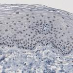 NOP56 Antibody in Immunohistochemistry (Paraffin) (IHC (P))