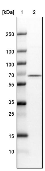 NOP56 Antibody in Western Blot (WB)