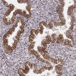 GRASP55 Antibody in Immunohistochemistry (IHC)