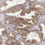 GRASP55 Antibody in Immunohistochemistry (IHC)