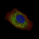 Laminin gamma-2 Monoclonal Antibody (CL2980)