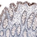 Laminin alpha-3 Antibody in Immunohistochemistry (Paraffin) (IHC (P))