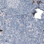 Laminin alpha-3 Antibody in Immunohistochemistry (Paraffin) (IHC (P))