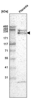 Laminin alpha-4 Antibody in Western Blot (WB)