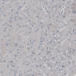 SSX2 Antibody in Immunohistochemistry (Paraffin) (IHC (P))