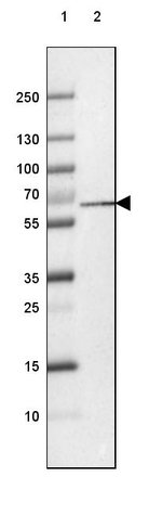 PGM1 Antibody in Western Blot (WB)