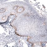 Laminin beta-3 Antibody in Immunohistochemistry (Paraffin) (IHC (P))