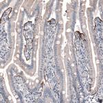 Laminin beta-3 Antibody in Immunohistochemistry (Paraffin) (IHC (P))