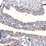 Laminin beta-3 Antibody in Immunohistochemistry (Paraffin) (IHC (P))