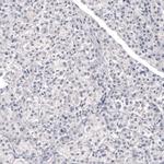 Laminin beta-3 Antibody in Immunohistochemistry (Paraffin) (IHC (P))