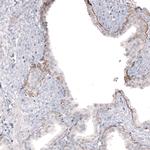 Laminin beta-3 Antibody in Immunohistochemistry (Paraffin) (IHC (P))
