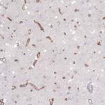 Laminin alpha-2 Antibody in Immunohistochemistry (IHC)