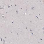 FCGRT Antibody in Immunohistochemistry (Paraffin) (IHC (P))