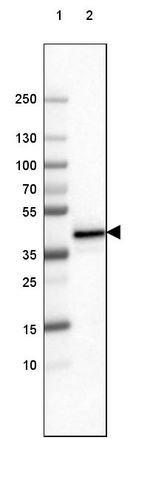 FCGRT Antibody in Western Blot (WB)