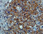 B-Raf (V600E) Recombinant Rabbit Monoclonal Antibody (RM8)
