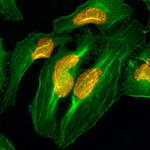 Histone H2A Recombinant Rabbit Monoclonal Antibody (RM225)