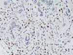 Phospho-Histone H3 (Thr3) Antibody in Immunohistochemistry (Paraffin) (IHC (P))