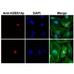 Phospho-Histone H2B (Ser14) Antibody in Immunocytochemistry (ICC/IF)