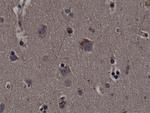 Phospho-RSK1 (Thr359, Ser363) Antibody in Immunohistochemistry (Paraffin) (IHC (P))