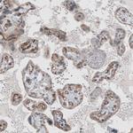 ELTD1 Antibody in Immunohistochemistry (IHC)