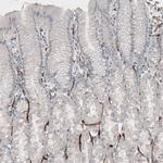 ELTD1 Antibody in Immunohistochemistry (IHC)