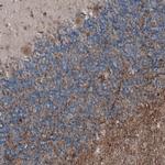 ELTD1 Antibody in Immunohistochemistry (IHC)