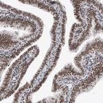 SMCHD1 Antibody in Immunohistochemistry (IHC)