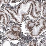 SMCHD1 Antibody in Immunohistochemistry (IHC)