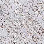SMCHD1 Antibody in Immunohistochemistry (IHC)
