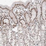 SMCHD1 Antibody in Immunohistochemistry (IHC)