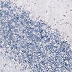 SMCHD1 Antibody in Immunohistochemistry (IHC)