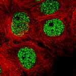 SMCHD1 Antibody in Immunocytochemistry (ICC/IF)
