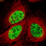 SMCHD1 Antibody in Immunocytochemistry (ICC/IF)