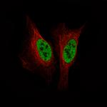 SMCHD1 Monoclonal Antibody (CL4270)