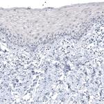 CT83 Monoclonal Antibody (CL4762)