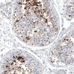 CT83 Antibody in Immunohistochemistry (IHC)