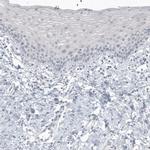 CT83 Antibody in Immunohistochemistry (IHC)