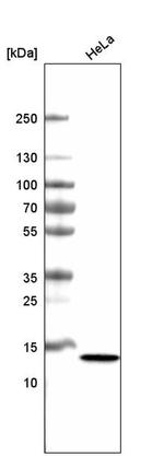 CT83 Antibody in Western Blot (WB)